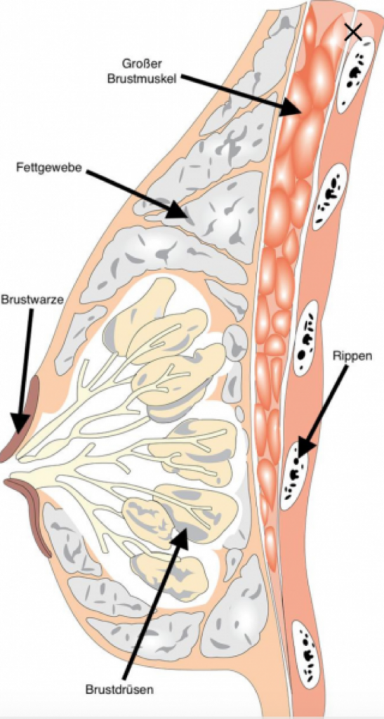 Man busen größere bekommt wie Größere Brüste